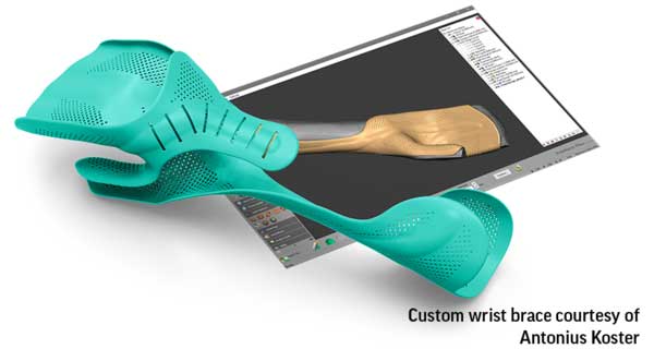 Geomagic-Freeform-2019-wrist-brace-Antonius-Koster-attribute.jpg