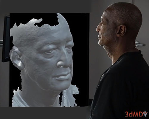 3dMDface System